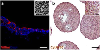 Intestine-Liver Axis On-Chip Reveals the Intestinal Protective Role on Hepatic Damage by Emulating Ethanol First-Pass Metabolism